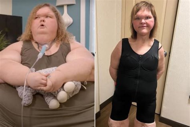 Astonishing Transformations: The Journey Of 