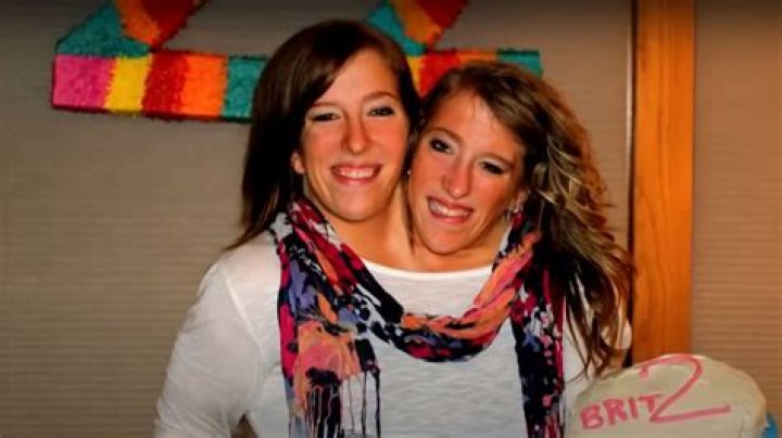 Current Status Of Conjoined Twins Abby And Brittany Hensel