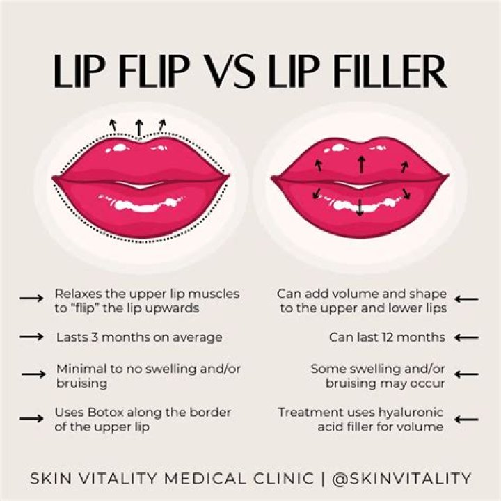 Discover Lip Flip Cleveland: Enhance Your Smile With Precision And Grace