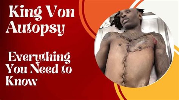 King Von's Shocking Autopsy Results: Uncovering The Tragic Details
