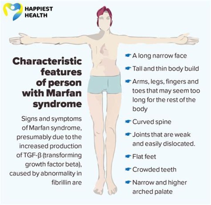 Understanding Barron Trump's Marfan Syndrome: Symptoms And Treatments