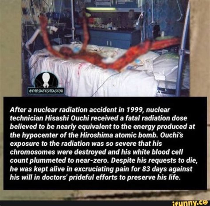 Unveiling The Ouchi Radiation Accident: Consequences And Legacy
