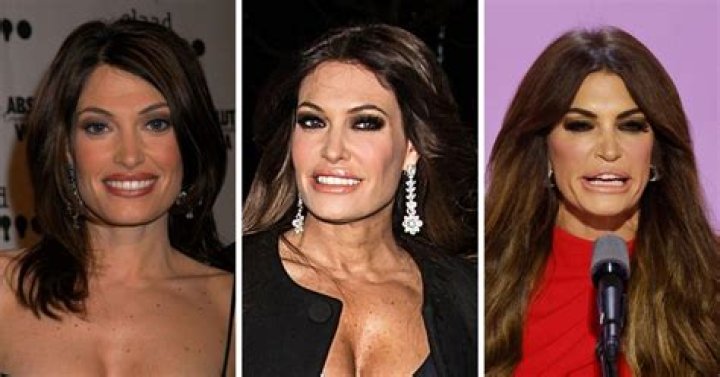 Unveiling The Transformation: Kimberly Guilfoyle's Plastic Surgery Journey