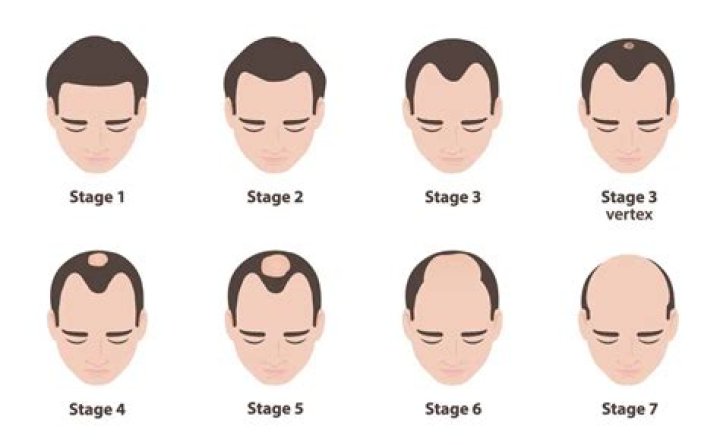 Why Jimmy Fallon's Baldness Is A Mystery Of The Ages